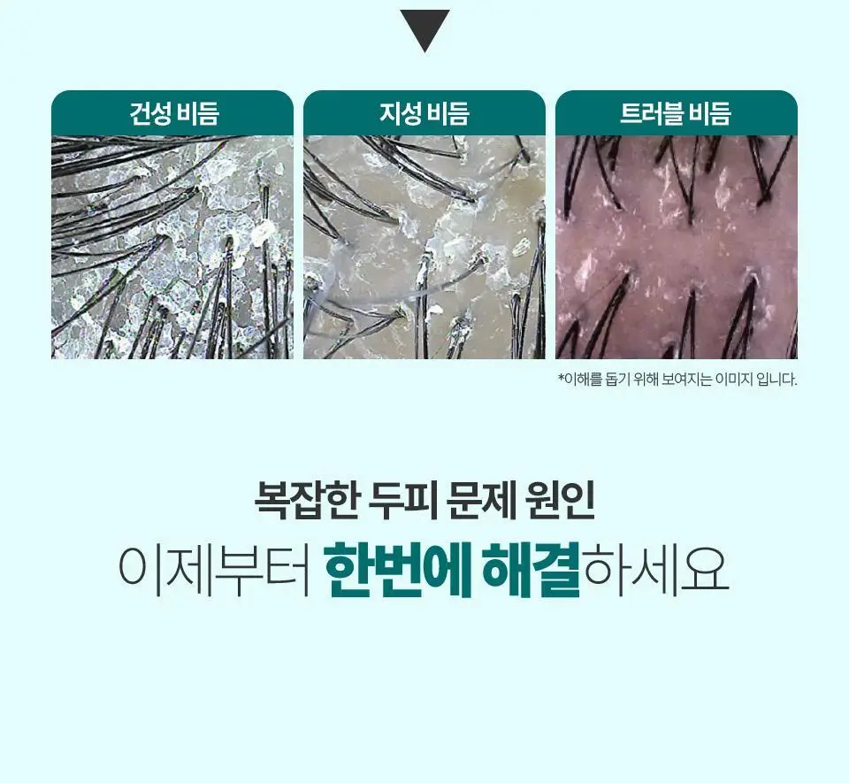 [비듬두피/정수리냄새] 트리셀 안티 댄드러프 샴푸 오션 브리즈 증정 기획(360ml+120ml) 상세페이지 9